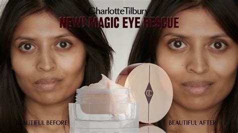 Magic Eye Rescue: The Skincare Holy Grail for Eye Bags and Puffiness